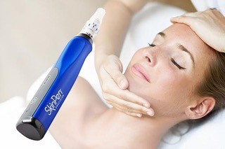 skin pen 2